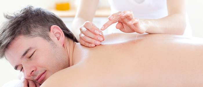 Dry Needling in Charlotte